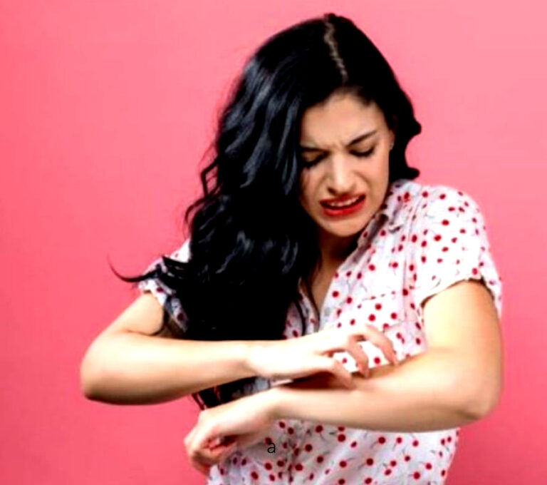 स्किन पर चकत्ते, लालिमा और दाने के साथ हो रही खुजली, तो हो सकता है ये संक्रामक रोग, जनिए बचाव के उपाय