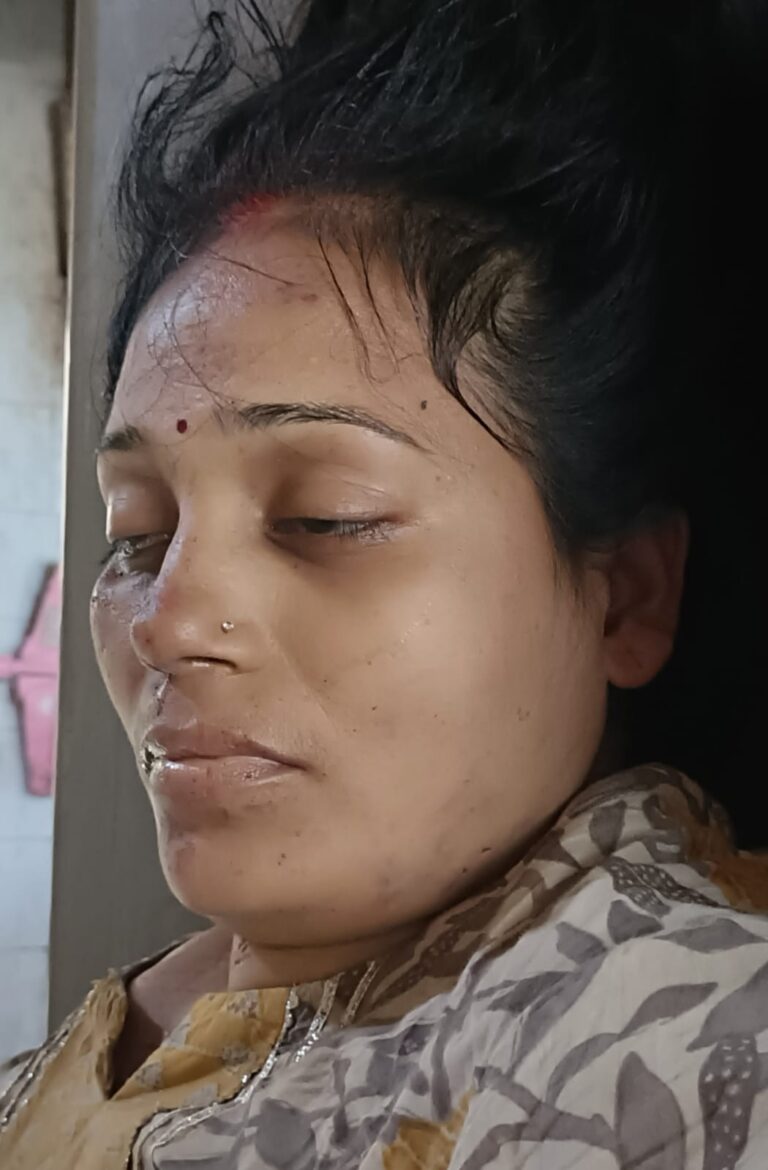 दुर्ग शहर स्थित बोरसी चौक में स्वाति पटेल पति शैलेन्द्र पटेल महिला कि ट्रक के चपेट में आने से दर्दनाक मौत दुर्घटनाएं होने के अनेकों कारण पढ़िए पूरी खबर…